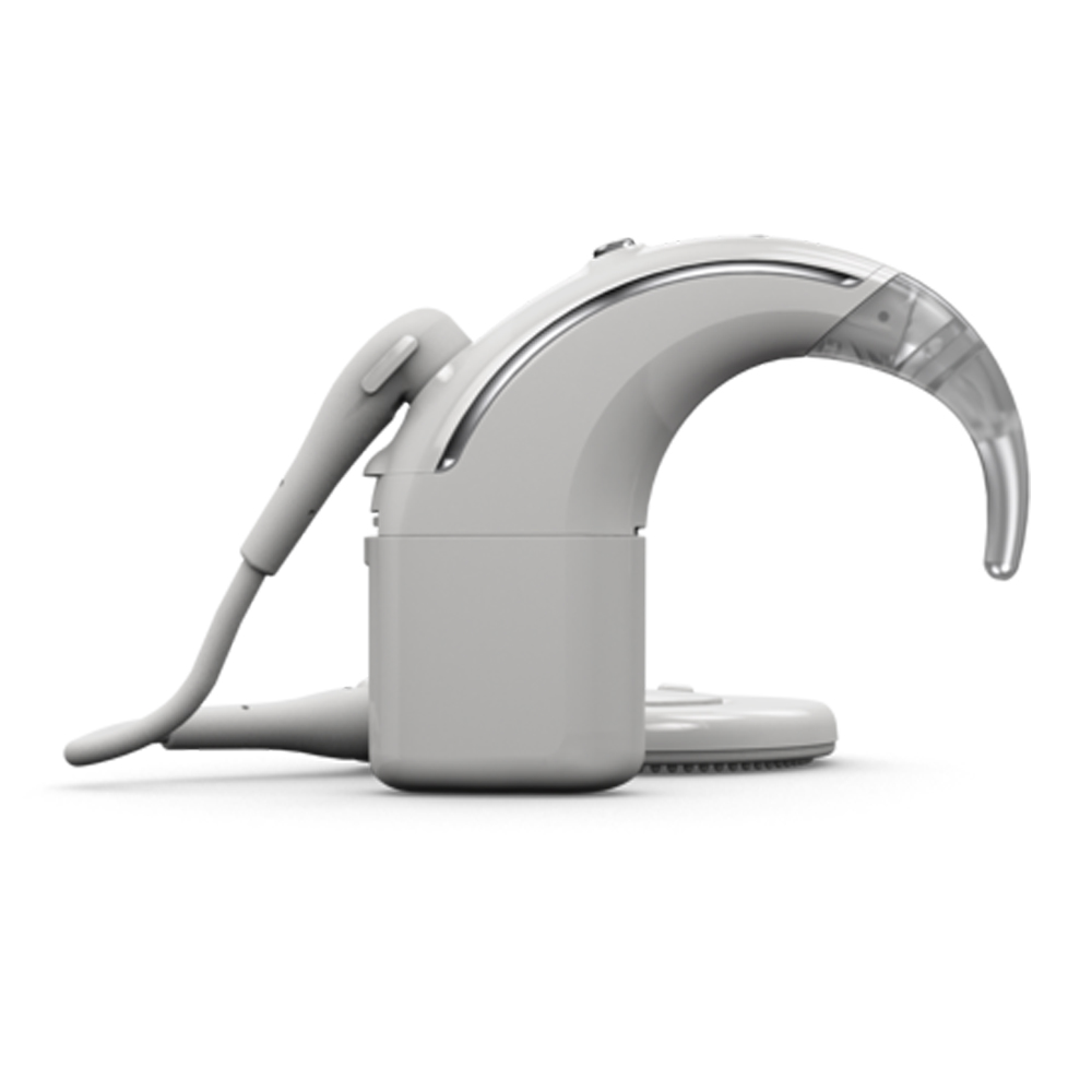 Cochlear Nucleus 8 Nexa